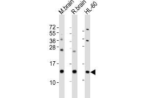 All lanes : Anti-FKBP1A Antibody (Center) at 1:2000 dilution Lane 1: mouse brain lysates Lane 2: rat brain lysates Lane 3: HL-60 whole cell lysates Lysates/proteins at 20 μg per lane. (FKBP1A 抗体  (AA 34-68))