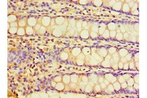 Immunohistochemistry of paraffin-embedded human rectum tissue using CHRFAM7A Antibody at a dilution of 1:100. (CHRFAM7A 抗体  (AA 1-150))