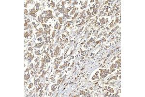 IHC analysis of TXNDC5 using anti-TXNDC5 antibody (ABIN7599699).