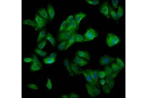 Immunofluorescence staining of HepG2 cells with ABIN7148760 at 1:200, counter-stained with DAPI. (Cullin 7 抗体  (AA 312-450))