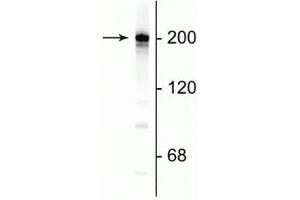 Western blot of rat cortical lysate showing specific immunolabeling of the ~200 kDa NF-H protein. (NEFH 抗体)