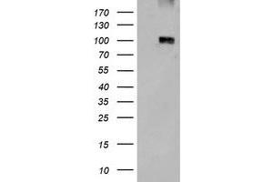 HEK293T cells were transfected with the empty vector control (Left lane) or Human LGR5 expression plasmid (Right lane) cDNA for 48 hrs and lysed.