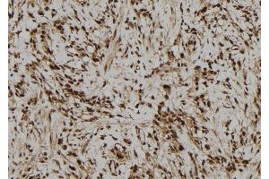ABIN6278875 at 1/100 staining Human gastric tissue by IHC-P. (IFI44 抗体  (Internal Region))