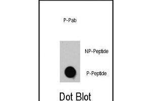 Dot blot analysis of anti-TSC2-p Phospho-specific Pab (R) on nitrocellulose membrane. (Tuberin 抗体  (pThr1462))