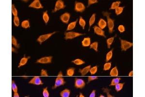 Immunofluorescence (IF) image for anti-Ribosomal Protein L17 (RPL17) antibody (ABIN7261878)