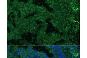 Immunofluorescence (IF) image for anti-Interleukin 25 (IL25) antibody (ABIN7264293)