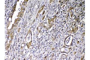 Immunohistochemistry (IHC) image for anti-Vitamin D-Binding Protein (GC) (AA 17-256) antibody (ABIN5518994)