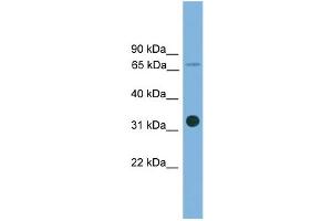 Western Blotting (WB) image for anti-Solute Carrier Family 5 (Low Affinity Glucose Cotransporter), Member 4 (SLC5A4) (Middle Region) antibody (ABIN2781637)