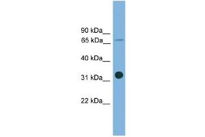 WB Suggested Anti-SLC5A4 Antibody Titration: 0. (SLC5A4 抗体  (Middle Region))