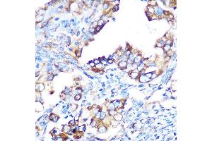Immunohistochemistry (IHC) image for anti-Y Box Binding Protein 1 (YBX1) antibody (ABIN7271410)