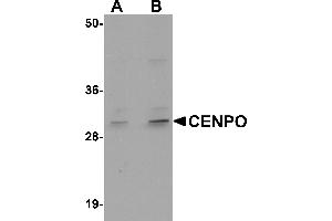 Western blot analysis of CENPO in mouse kidney tissue lysate with CENPO antibody at (A) 1 and (B) 2 µg/mL.