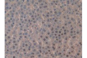 DAB staining on IHC-P; Samples: Rat Liver Tissue (TOP2 抗体  (AA 1079-1328))