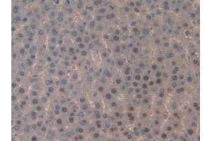 DAB staining on IHC-P; Samples: Rat Liver Tissue (TOP2 抗体  (AA 1079-1328))