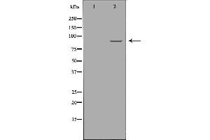 Western blot analysis of A549  using RRM1 antibody. (RRM1 抗体  (Internal Region))