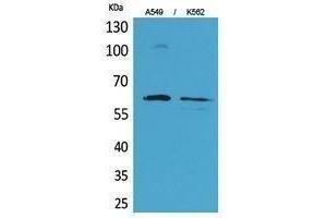 Western Blotting (WB) image for anti-SMAD, Mothers Against DPP Homolog 1 (SMAD1) (Ser794) antibody (ABIN3180401) (SMAD1 抗体  (Ser794))