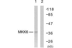 Western Blotting (WB) image for anti-Mitogen-Activated Protein Kinase Kinase 3 (MAP2K3) (Ser207) antibody (ABIN1848130) (MAP2K3 抗体  (Ser207))