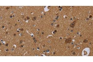 Immunohistochemistry of paraffin-embedded Human brain using NDUFS8 Polyclonal Antibody at dilution of 1:50