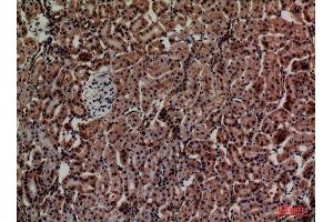 Immunohistochemistry (IHC) image for anti-Adrenomedullin (ADM) (Internal Region) antibody (ABIN6285379)
