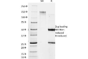SDS-PAGE Analysis Purified RANK Giardia lamblia Mouse Monoclonal Antibody (BB1. (Giardia Lamblia 抗体)