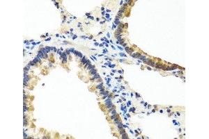 Immunohistochemistry of paraffin-embedded Rat lung using ANGPT1 Polyclonal Antibody at dilution of 1:100 (40x lens). (Angiopoietin 1 抗体)