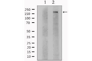 Western blot analysis of extracts from Hela, using ITGAM Antibody. (CD11b 抗体  (Internal Region))