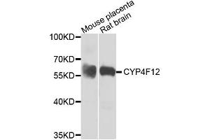 Western blot analysis of extracts of mouse placenta and rat brain, using CYP4F12 antibody. (CYP4F12 抗体)