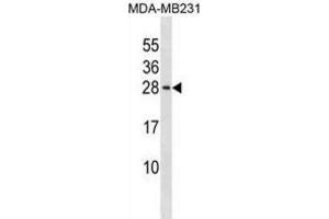 Western Blotting (WB) image for anti-Peptidyl Prolyl Cis/Trans Isomerase NIMA Interacting 4 Protein (PIN4) antibody (ABIN3000322) (PIN4 抗体)