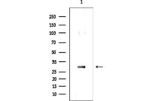 Western blot analysis of lysates from EC304 cells, using NIPSNAP1 Mouse Monoclonal Antibody at 1/1000 dilution. (NIPSNAP1 抗体)