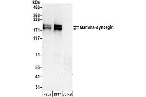 anti-Synergin gamma (SYNRG) (AA 975-1025) antibody