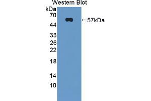 Western blot analysis of the recombinant protein. (Dysferlin 抗体  (AA 1-479))