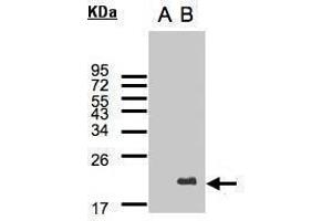 WB Image Western Blot analysis of UBE2C expression in transfected 293T cell line by UBE2C polyclonal antibody. (UBE2C 抗体)