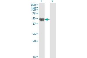Western Blot analysis of KRT20 expression in transfected 293T cell line by KRT20 monoclonal antibody (M01), clone 2G3-1C8.