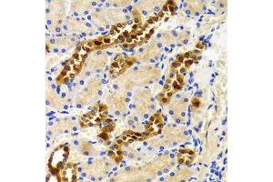Immunohistochemistry of paraffin-embedded rat kidney using PIWIL4 antibody (ABIN5971612) at dilution of 1/100 (40x lens). (PIWIL4 抗体)