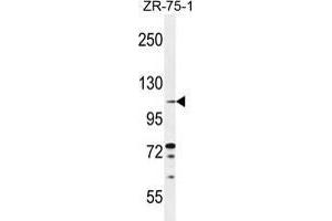 TLL2 Antibody (Center) western blot analysis in ZR-75-1 cell line lysates (35 µg/lane). (Tolloid-Like 2 抗体  (Middle Region))