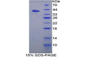 SDS-PAGE (SDS) image for Plasminogen (PLG) (AA 98-436) protein (His tag) (ABIN2121898)