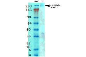 Western Blot analysis of Rat brain membrane lysate showing detection of Cav3. (CACNA1G 抗体  (AA 2052-2172) (Atto 594))
