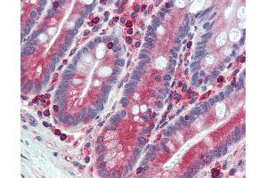 Immunohistochemistry (IHC) image for anti-Extended Synaptotagmin-Like Protein 1 (ESYT1) (C-Term) antibody (ABIN960776)