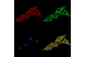 HSP60 Mouse Monoclonal Antibody staining HepG2 cells by IF/ICC.