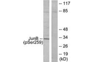 Western Blotting (WB) image for anti-Jun B Proto-Oncogene (JUNB) (pSer259) antibody (ABIN2888458) (JunB 抗体  (pSer259))