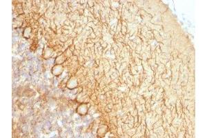 Formalin-fixed, paraffin-embedded rat cerebellum stained with Neurofilament antibody (NR-4). (Neurofilament 抗体)