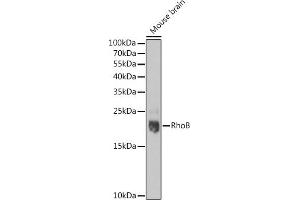 Western blot analysis of extracts of Mouse brain, using RhoB pAb  at 1:1000 dilution. (RHOB 抗体  (C-Term))