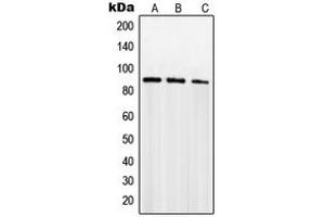 Western blot analysis of SENP5 expression in PC12 (A), Jurkat (B), NIH3T3 (C) whole cell lysates. (SENP5 抗体  (C-Term))