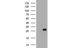Image no. 2 for anti-B-Cell CLL/lymphoma 10 (BCL10) antibody (ABIN1496848) (BCL10 抗体)