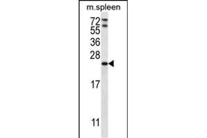 RA Antibody (C-term) 2949b western blot analysis in mouse spleen tissue lysates (35 μg/lane).