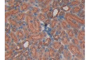 Immunohistochemistry (IHC) image for anti-Hexokinase 1 (HK1) (AA 413-540) antibody (ABIN7437755)