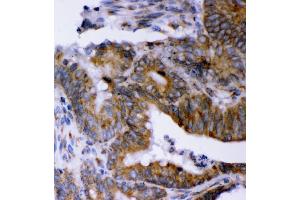 IHC analysis of LYRIC using anti-LYRIC antibody (ABIN7599627).
