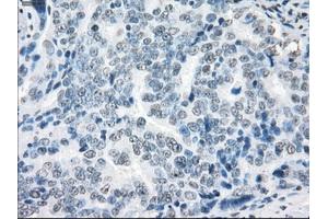 Immunohistochemical staining of paraffin-embedded colon tissue using anti-XRCC4mouse monoclonal antibody. (XRCC4 抗体)