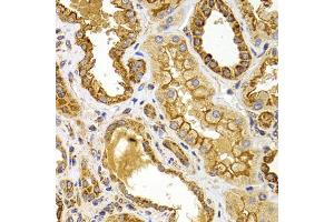 Immunohistochemistry of paraffin-embedded human kidney using BMP15 antibody (ABIN5975746) at dilution of 1/100 (40x lens). (BMP15 抗体)