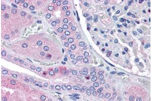 Human Kidney (formalin-fixed, paraffin-embedded) stained with RNF213 antibody ABIN290197 at 2. (RNF213 抗体  (AA 5244-5254))
