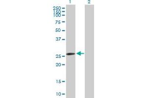 Western Blot analysis of AK2 expression in transfected 293T cell line by AK2 MaxPab polyclonal antibody. (Adenylate Kinase 2 抗体  (AA 1-239))